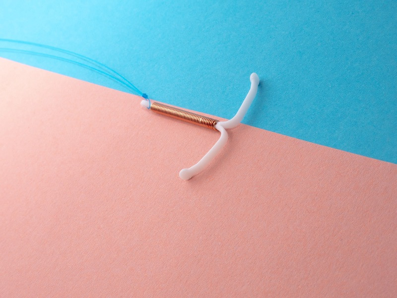 Ketahui Perbedaan IUD Hormonal dan IUD Tembaga