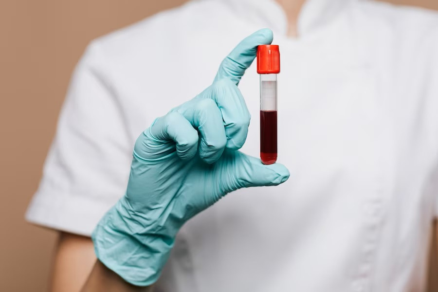 Mengenal Apa itu Masalah Ketidakcocokan Rhesus (Rh)