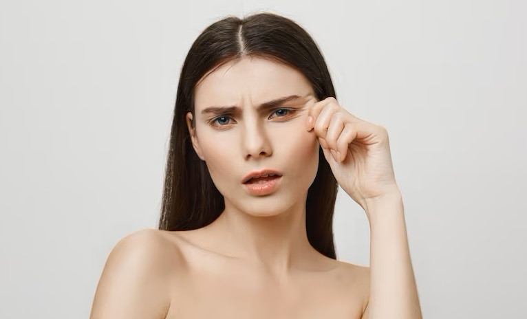 Cara Mencegah Garis Kerutan di Bawah Mata